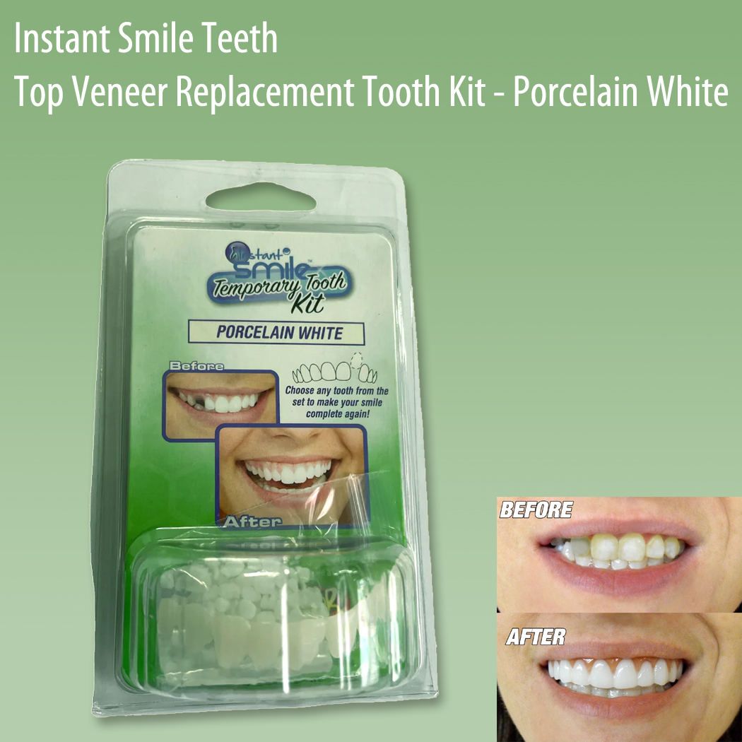 Instant Smile Teeth Top Veneer Replacement Tooth Kit - Porcelain