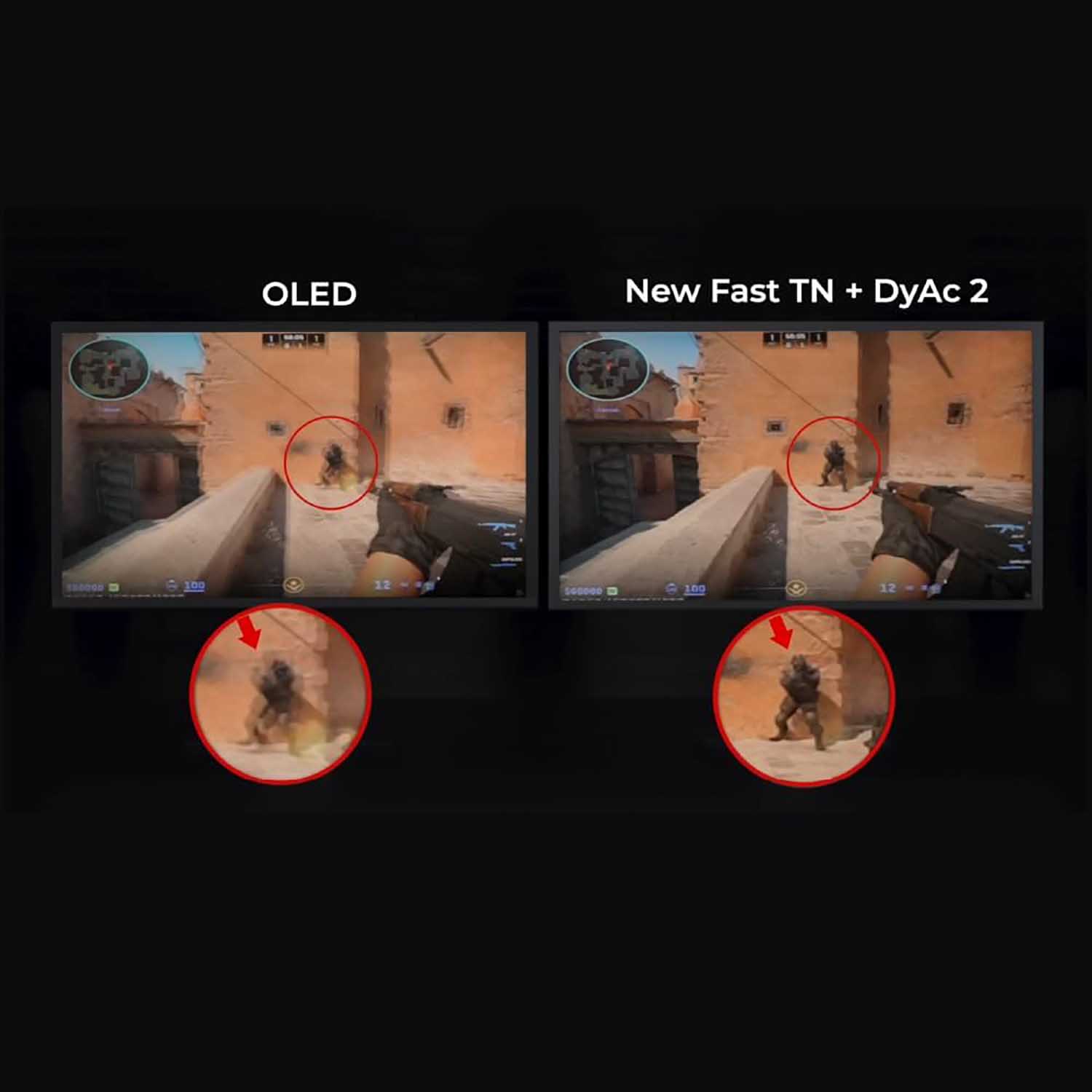 BenQ XL2566X+ front view with stand